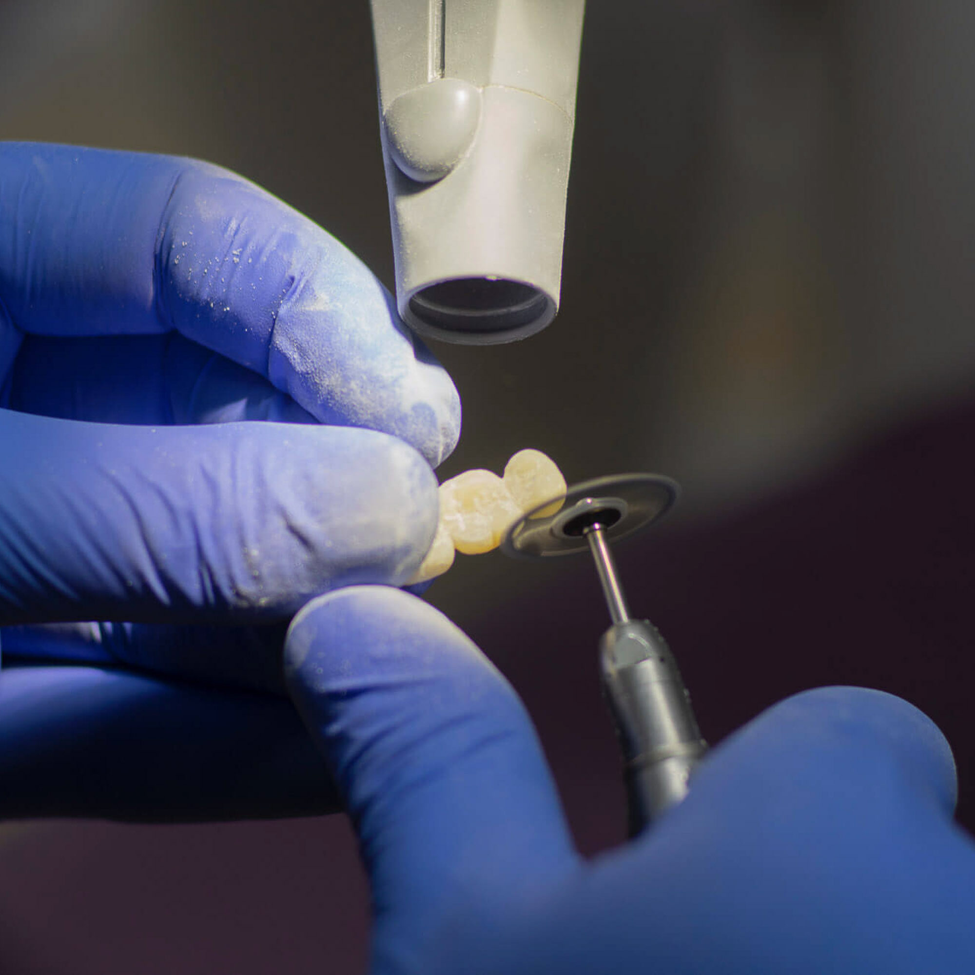 Crown and Bridgesmallsmall dental crown and dental bridges