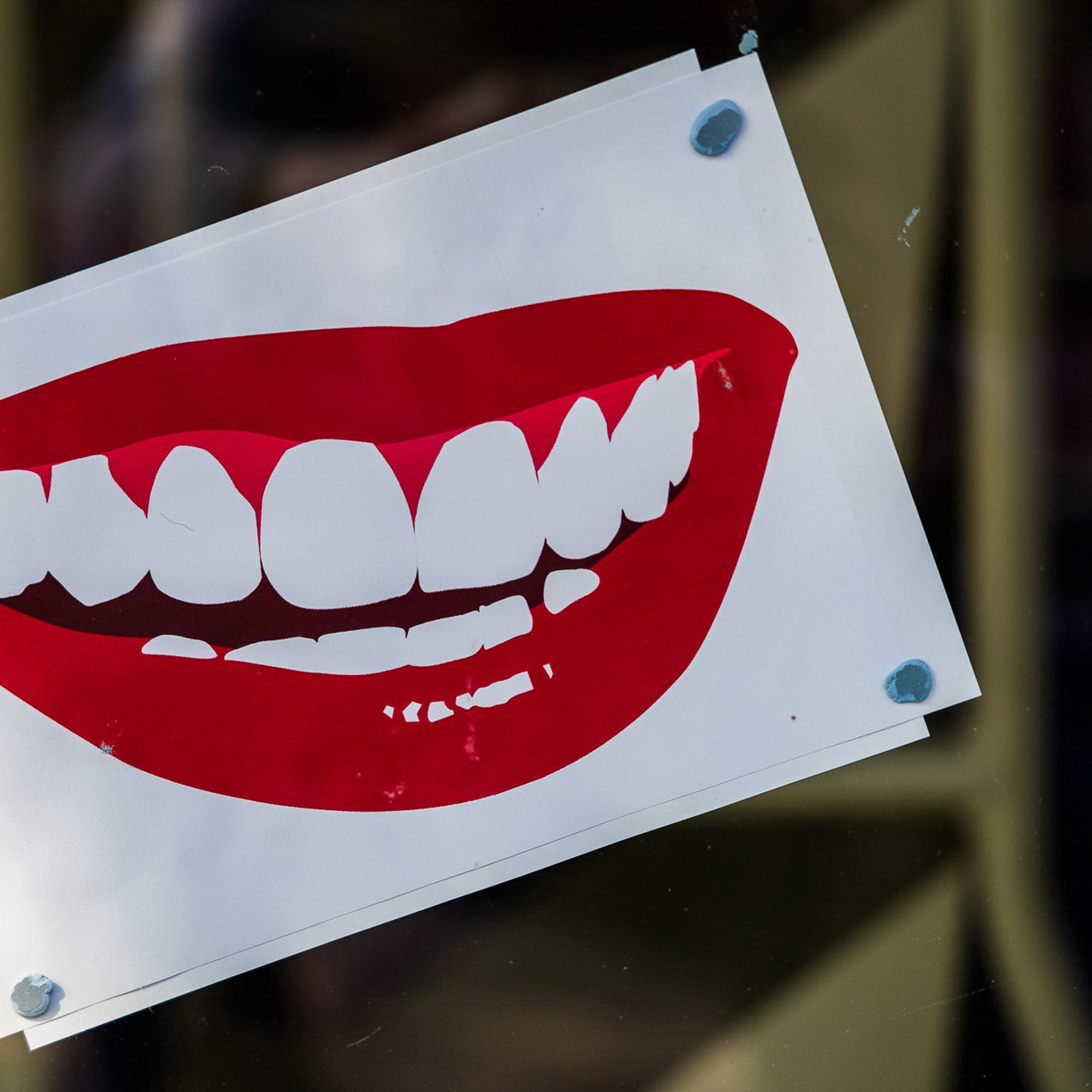 Teeth Whiteningsmallsmall Teeth Whiting at Rockwood Dental